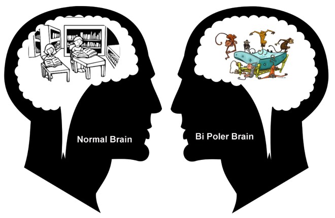 Normal vs Bipolar Brain